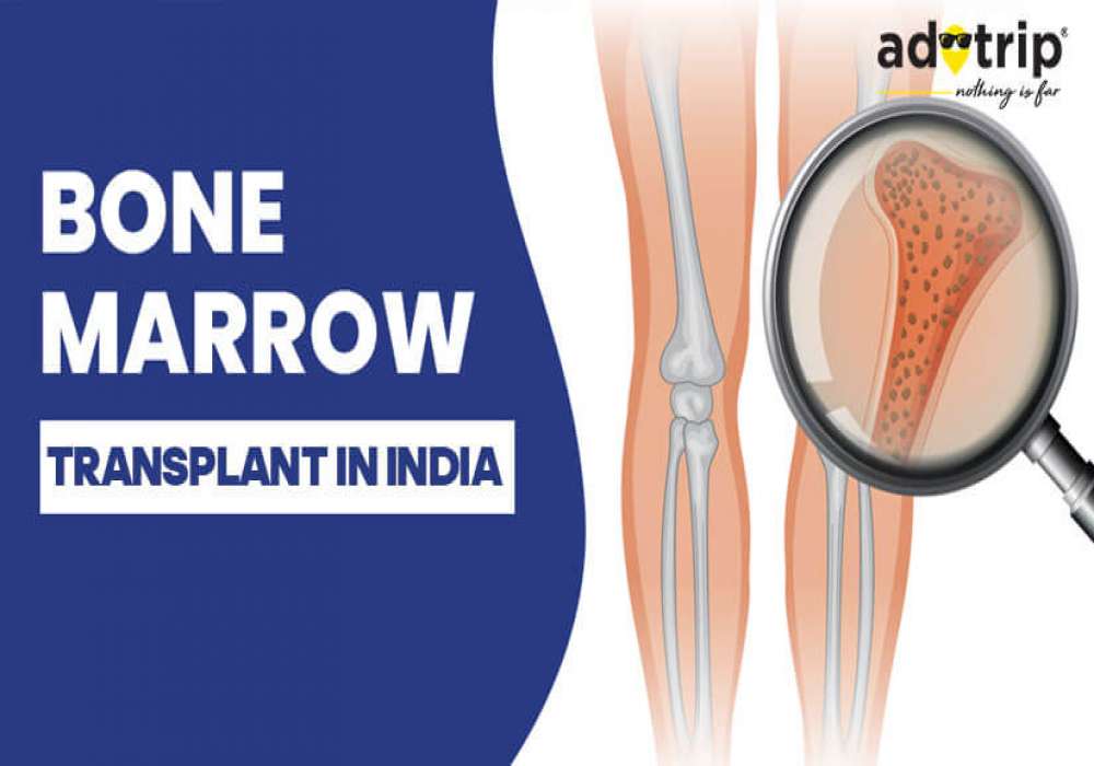 Bone Marrow Transplant Cost in India
